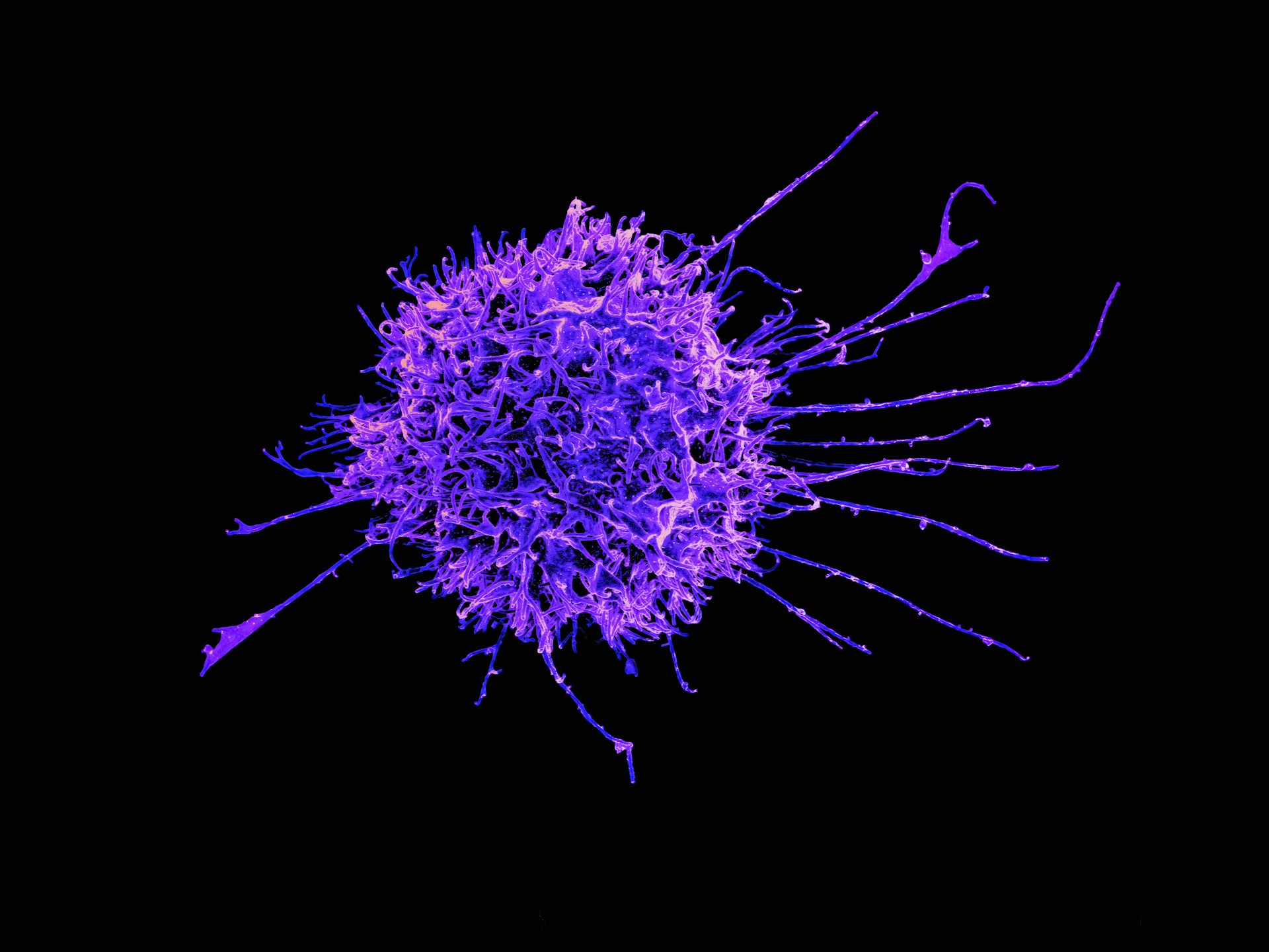 How Sleep Affects Your Immune System (The Science Is Striking)